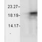 Alpha B Crystallin Antibody