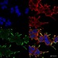 Alpha B Crystallin Antibody