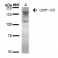 GRP170 Antibody
