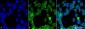 PP5 Antibody 