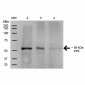 PP5 Antibody 