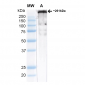Cav3.2 Antibody