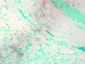 KCNQ1 Antibody