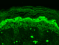 GluN2B/NR2B Antibody