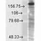 GluN2B/NR2B Antibody