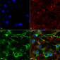 KCC2 Antibody