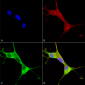 Copper Transporting ATPase 1 Antibody