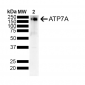 Copper Transporting ATPase 1 Antibody