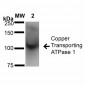 Copper Transporting ATPase 1 Antibody