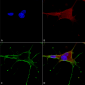GluN1/NR1 Antibody