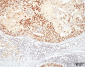 HSF1 Antibody