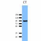 Calnexin-CT Antibody