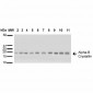 Alpha B Crystallin Antibody