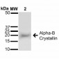 Alpha B Crystallin Antibody