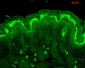 Calcineurin A Antibody