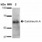 Calcineurin A Antibody