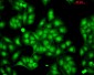 HSP22 Antibody