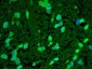 HSP22 Antibody