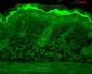 Calnexin-CT Antibody