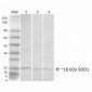 SOD1 (UbetaB) Antibody