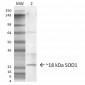 SOD1 (EDI) Antibody