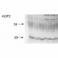 Aquaporin 2 Antibody