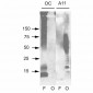 Amyloid Oligomers (A11) Antibody