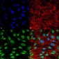 SQSTM1 Antibody