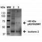 SQSTM1 Antibody