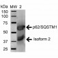 SQSTM1 Antibody