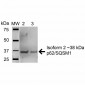 SQSTM1 Antibody