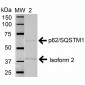 SQSTM1 Antibody