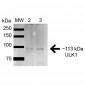 ULK1 Antibody