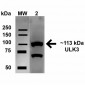 ULK2 Antibody