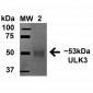 ULK3 Antibody