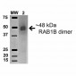 RAB1B Antibody