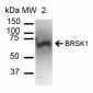 BRSK1 Antibody