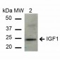 IGF-1 Antibody