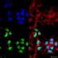 Choline Acetyltransferase Antibody