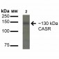 Calcium Sensing Receptor Antibody