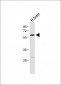 RORA Antibody (T216)