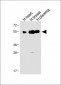 ENT1 Antibody (C-term)