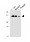 ENT1 Antibody (C-term)