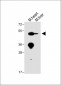 ENT1 Antibody (C-term)