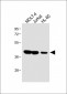 ADA Antibody (C-term)