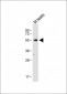 WT1 Antibody (Center E361)