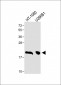 CTAG1A Antibody (N-term)