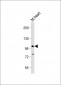 Mouse TLR2 Antibody (C-term)