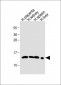 HBE1 Antibody(Center)