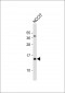 HBE1 Antibody(Center)